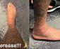 Neymar posta foto do tornozelo inchado aps leso: 'Bora'