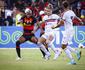 O jogo do Sport e Santa Cruz vai ser televisionado pela Globo? Saiba onde assistir o Clssico das Multides hoje (20/01)
