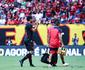 Z Roberto precisar fazer cirurgia na mo e desfalca Sport por um ms
