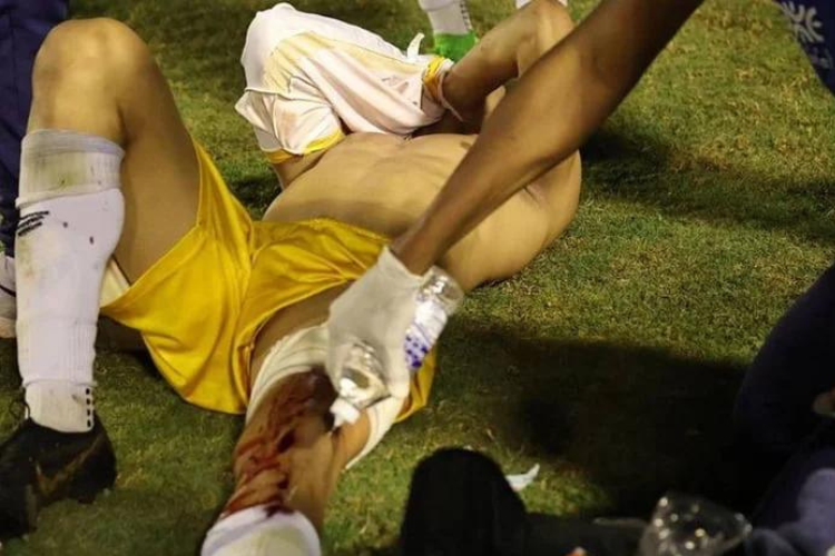 Goleiro dentro de campo leva tiro na perna disparado por PM; confira vdeo