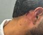 Massagista do Nutico  atingido por pedra aps clssico contra Sport; Eduardo Granja cobra punio